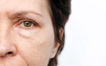 چرا صبح‌ها صورتمان پف می‌کند؟ دلایل علمی و راهکارهای کاهش التهاب صبحگاهی
