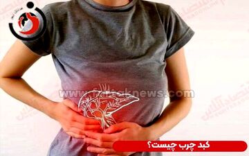  علائم «کبد چرب» چیست؟+ رژیم غذایی درمانی