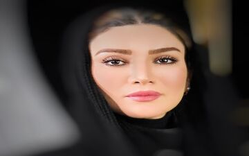 بازیگران زن ایرانی رکوددار عمل های زیبایی/ از الناز حبیبی تا نیوشا ضیغمی
