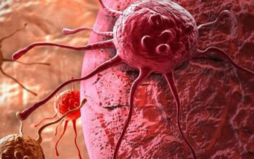 برای پیشگیری از سرطان این کارها را انجام ندهید/طب سنتی