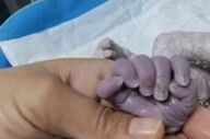 جان مادر باردار در بیمارستان رازی ایلام نجات یافت