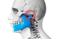 راهکارهای موثر در کاهش علایم و مشکلات مفصل فکی گیجگاهی