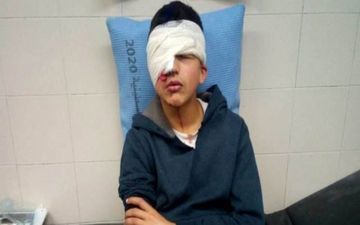 نوجوان فلسطینی به ضرب گلوله صهیونیست‌ها یک چشم خود را از دست داد