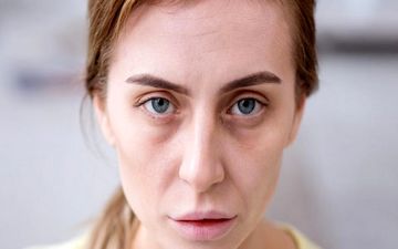 این علائم ساده را جدی بگیرید نشانه کم خونی است!/ این افراد جز گروه های پرخطرند