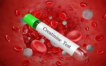 آزمایش کراتین خون چیست و در چه مواردی باید انجام شود؟