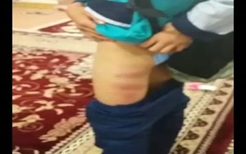 ماجرای تلخ تنبیه‌بدنی دانش‌آموز در مدرسه