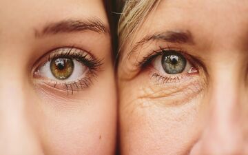 پوست صورت از چه سنی و چرا پیر میشود؟