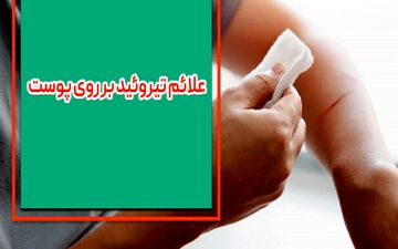 علائم تیروئید بر روی پوست چیست؟