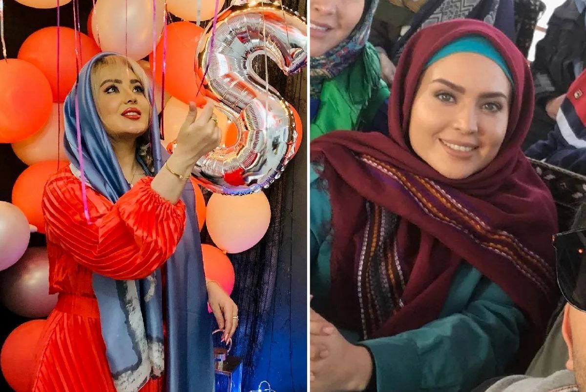 تولد "سولماز آقمقانی" با چهره‌ای پف کرده و پر از پروتز+عکس