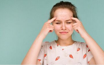 چرا آکنه و جوش در تابستان بیشتر می‌شود؟
