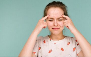 چرا آکنه و جوش در تابستان بیشتر می‌شود؟
