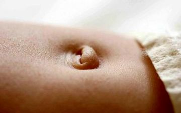 فتق ناف چه زمانی برطرف می شود؟