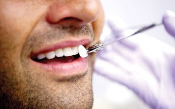 "لبخند هالیوودی" به چه قیمت؟/ آیا تراشیدن دندان خطرناک است؟