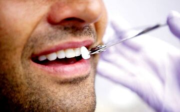 "لبخند هالیوودی" به چه قیمت؟/ آیا تراشیدن دندان خطرناک است؟
